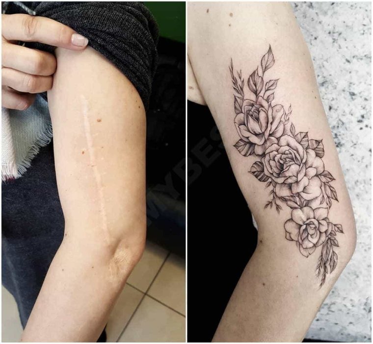 Татуировки прекрасно скрывающие шрамы 6