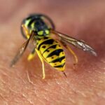 Что делать если укусила оса или пчела 61 Barbara Palvin