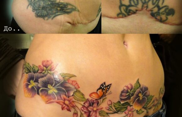 🖤 Татуировки на шраме от кесарева: скрываем шов (45 фото)