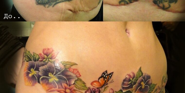 🖤 Татуировки на шраме от кесарева: скрываем шов (45 фото)