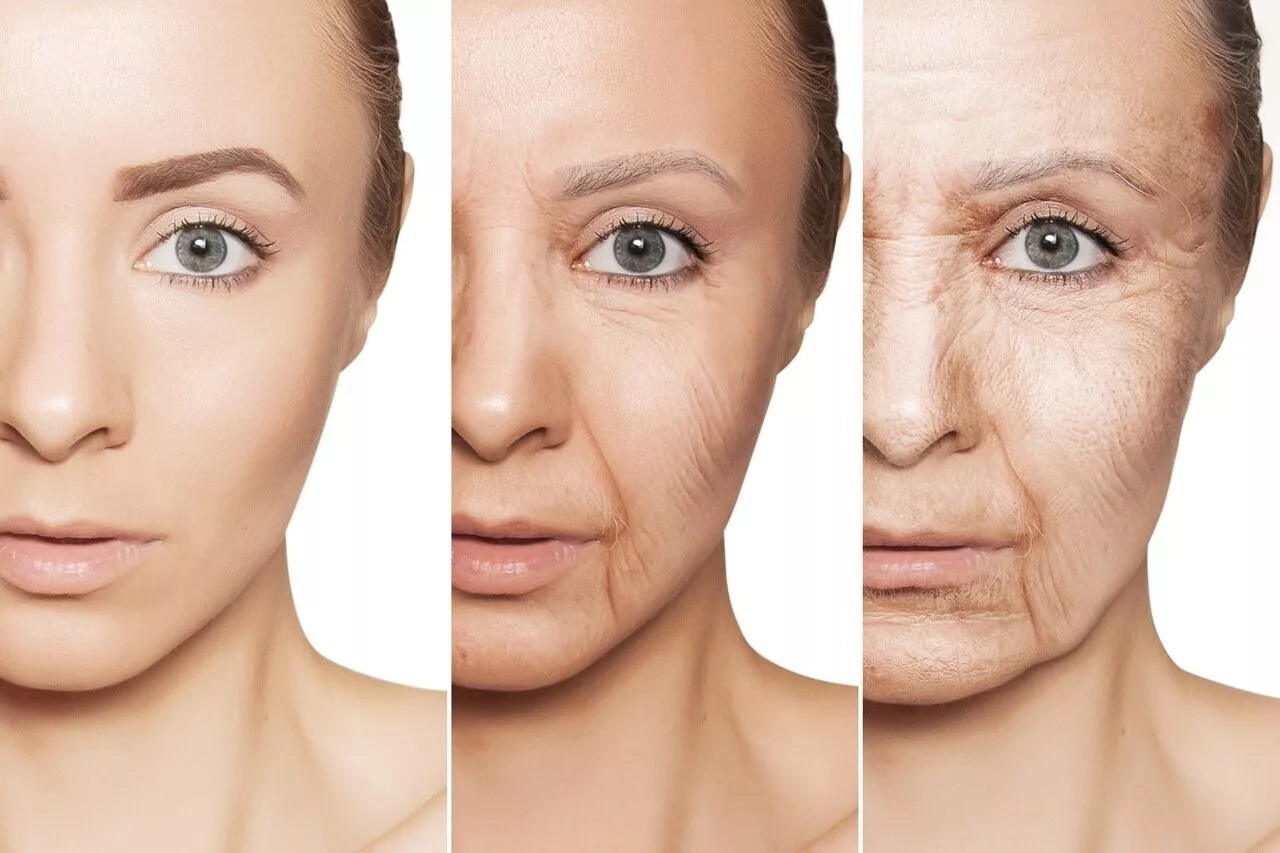 Старение кожи — как замедлить этот процесс 1