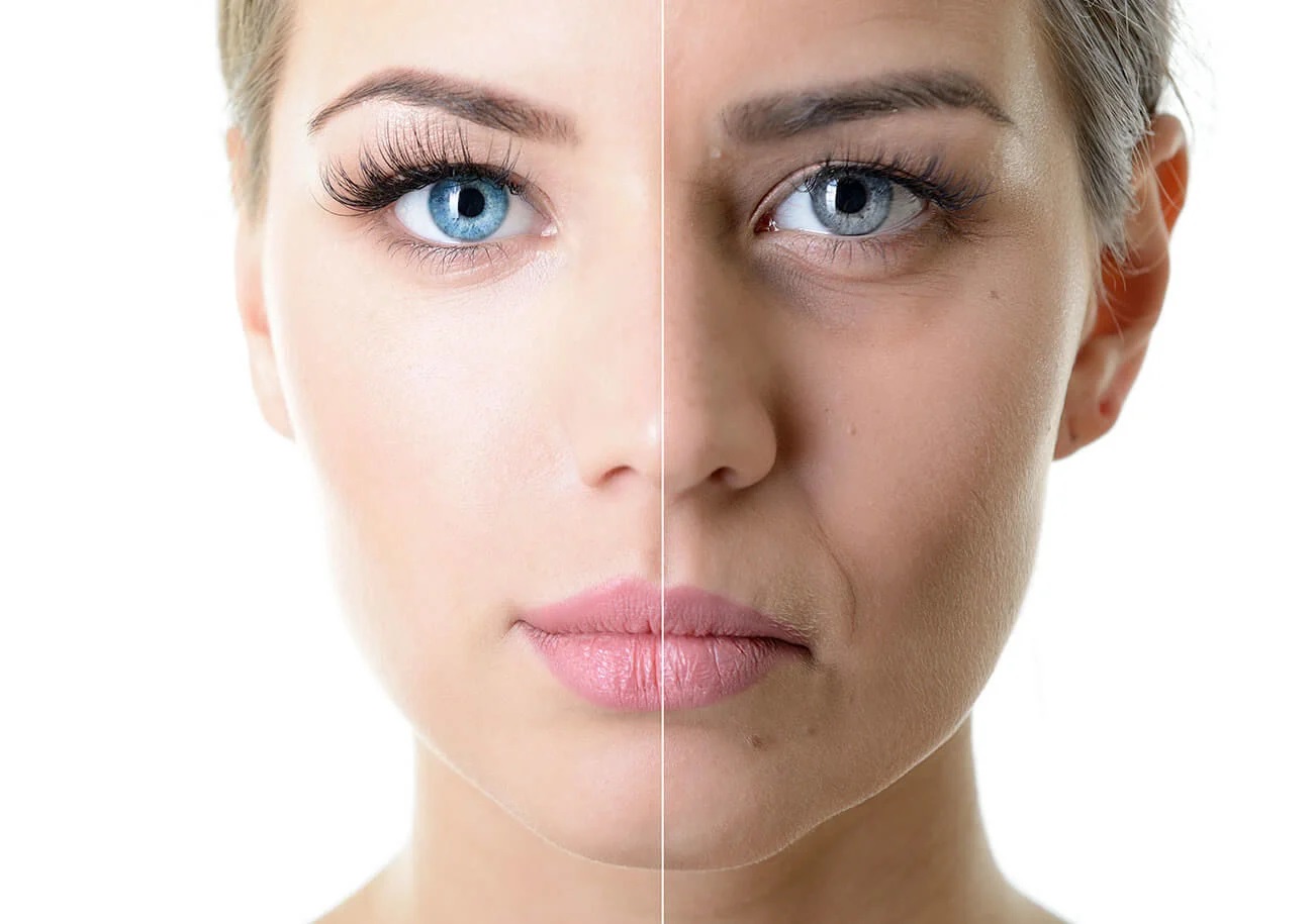 Старение кожи — как замедлить этот процесс 2