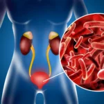 Белок в моче и соотношение белка к креатинину в моче 3